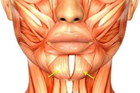 Dimpled Chin 2 | Derma Medical